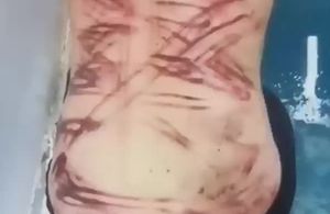 缅甸缅北男猪仔在园区打的浑身都是伤视频