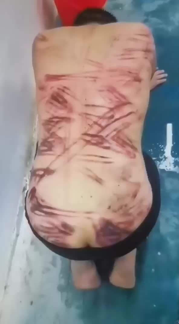 缅甸缅北男猪仔在园区打的浑身都是伤视频