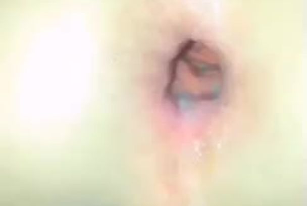 年幼小男孩被逆天爸爸后入爆菊内射灌满操出大黑洞令人震惊视频